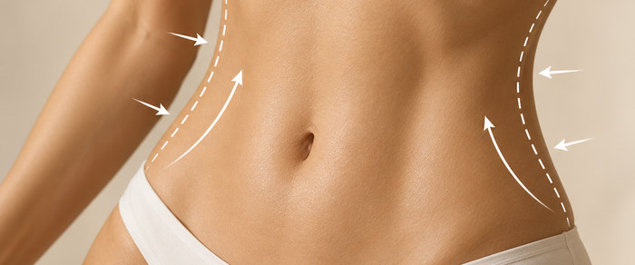 Body contouring treatment on the abdomen